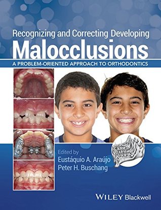 Full Download Recognizing and Correcting Developing Malocclusions: A Problem-Oriented Approach to Orthodontics - Eustáquio A. Araújo | ePub